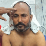 लखनऊ में दिवाली की रात चली गोली: पटाखे दगाने से नाराज पड़ोसी ने अधिवक्ता के सिर पर चलाई गोली